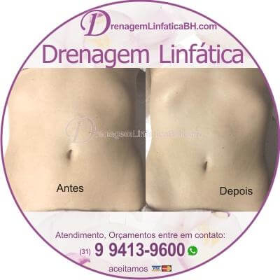 Drenagem Linfática também para Fins Estéticos e redução de medidas. Slimming Brazilian Massage by Brazilian Certified Massage Therapist